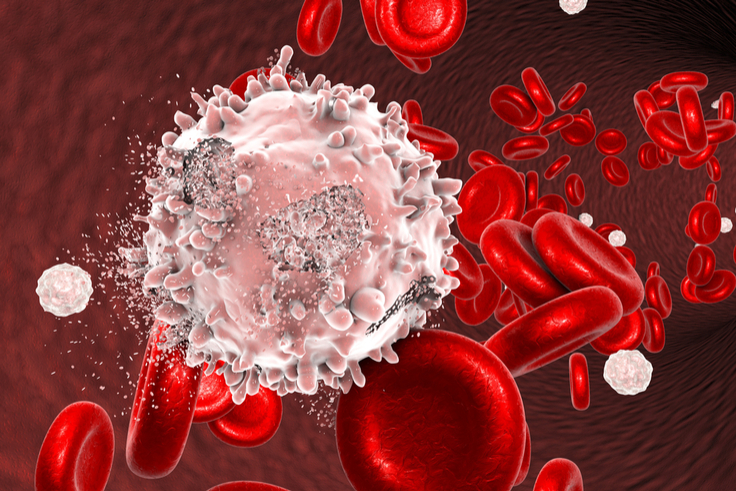 NGS to Detect Blood Cancers